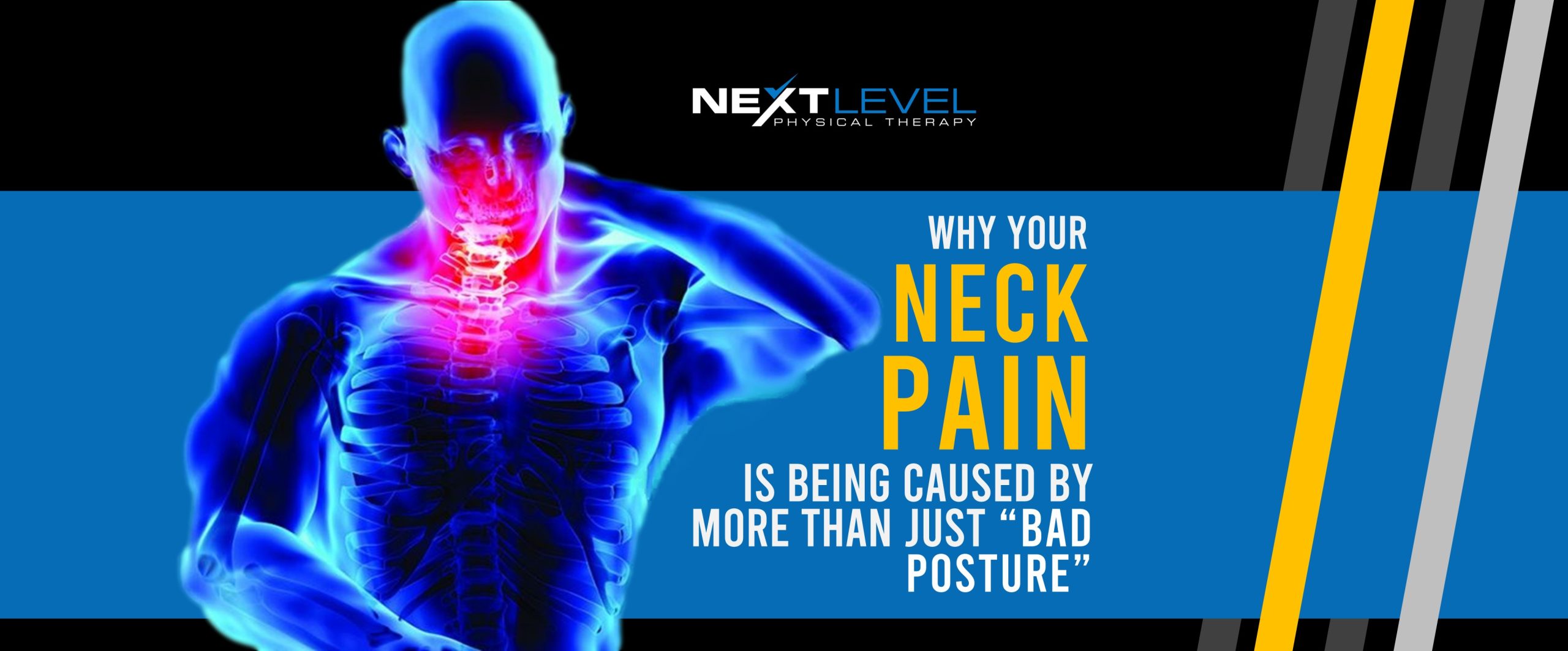 Bad Neck Pain Relief