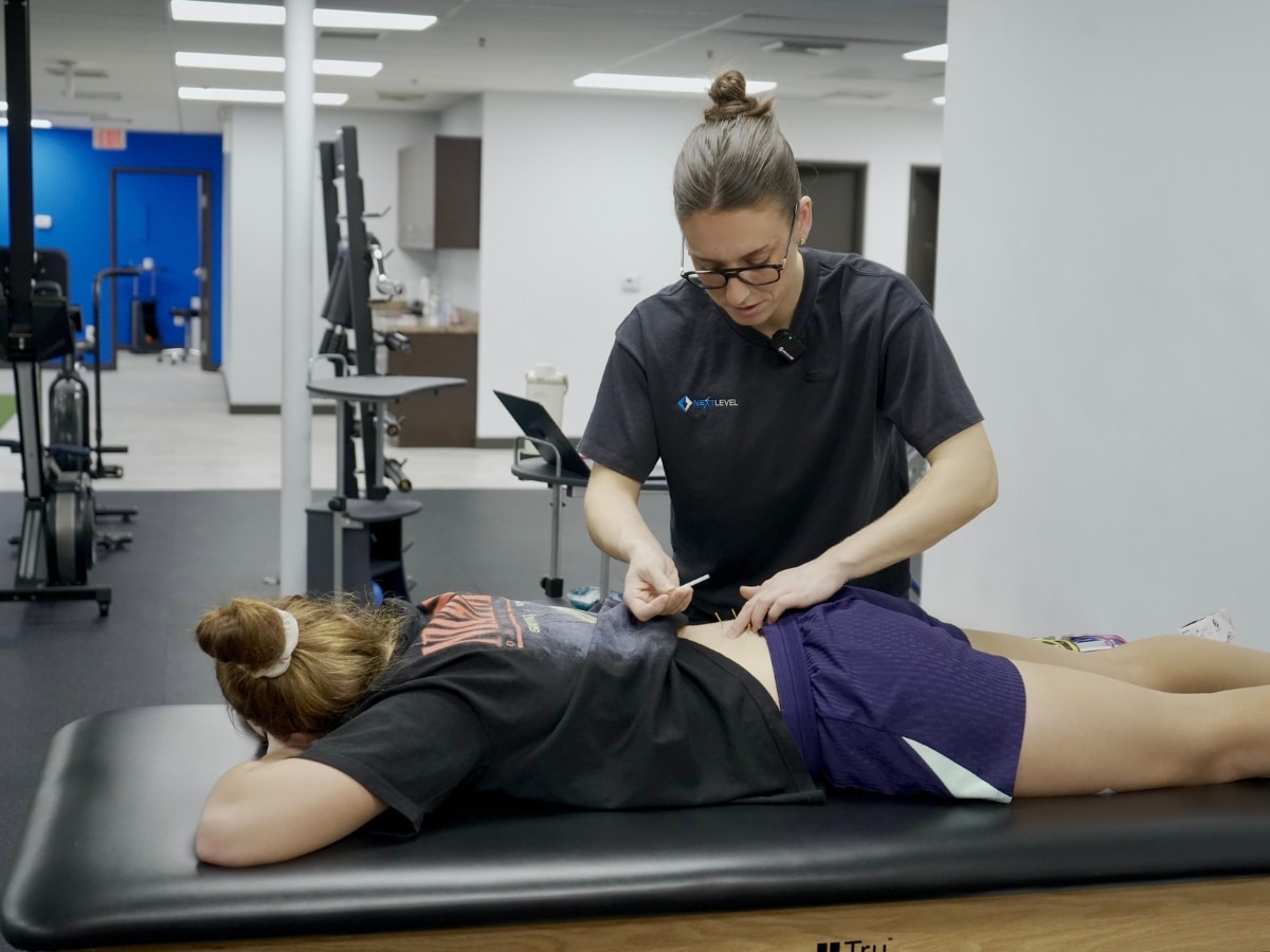 CLINICIAN PERFORMING DRY NEEDLING IN A CLINICAL SETTING